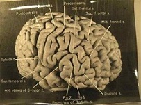 Ο “ιδιαίτερος” εγκέφαλος του Αϊνστάιν και η απίστευτη περιπέτειά του!