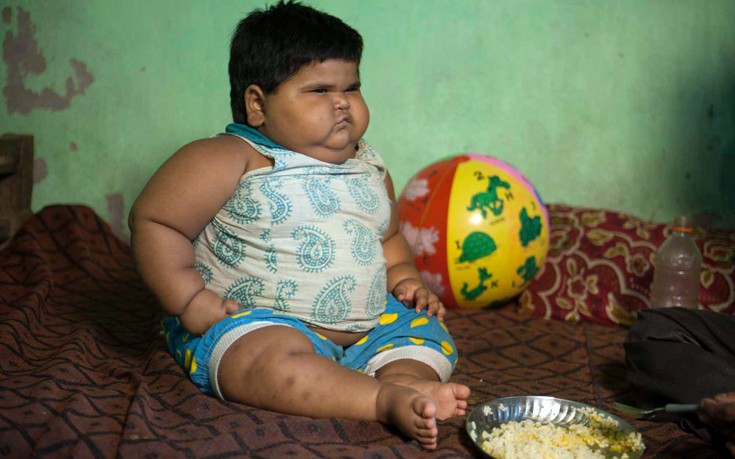 Ανεξήγητη η υπόθεση του παχύσαρκου μωρού της Ινδίας
