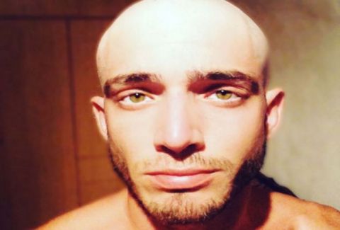 Θεοχάρης Ιωαννίδης: Η φωτογραφία χωρίς μαλλιά και το μήνυμα για το πρόβλημα υγείας του! (φωτό)