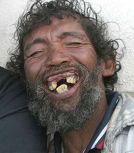 Αντέχεις; Αυτή είναι η πιο άσχημοι άντρες του Κόσμου και δεν «Μασάνε» να το δείξουν. - Εικόνα3