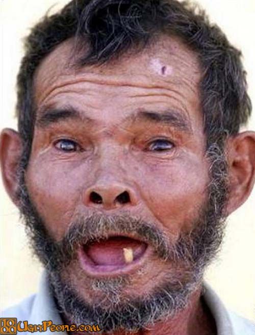 Αυτοί είναι oι πιο άσχημοι άντρες του κόσμου και το δείχνουν! (φωτό) Pronews.gr