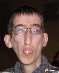 Αντέχεις; Αυτή είναι η πιο άσχημοι άντρες του Κόσμου και δεν «Μασάνε» να το δείξουν. - Εικόνα9