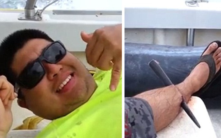 O ψαράς που ποζάρει και χαμογελά με… τρυπημένο πόδι – Δείτε φωτογραφίες και βίντεο