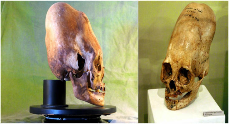 craneos-patacas-piedra-del-misterio