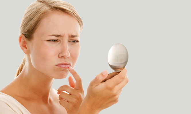 Τι σημαίνουν οι λευκές κηλίδες στα χείλη (φωτό)