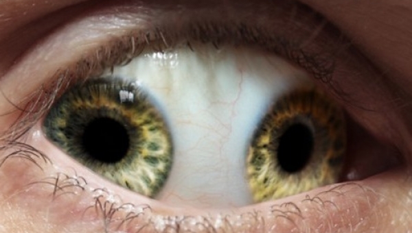 Οι 10 πιο παράξενες ασθένειες στην ιστορία της ιατρικής (βίντεο)