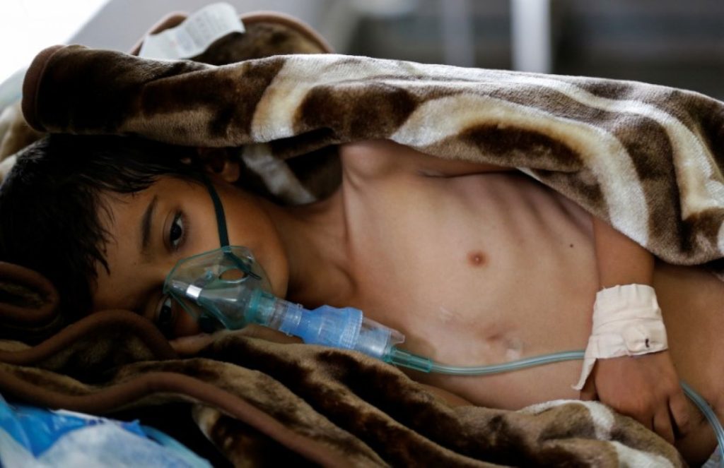 Υεμένη: Σχεδόν 600 νεκροί από την χολέρα