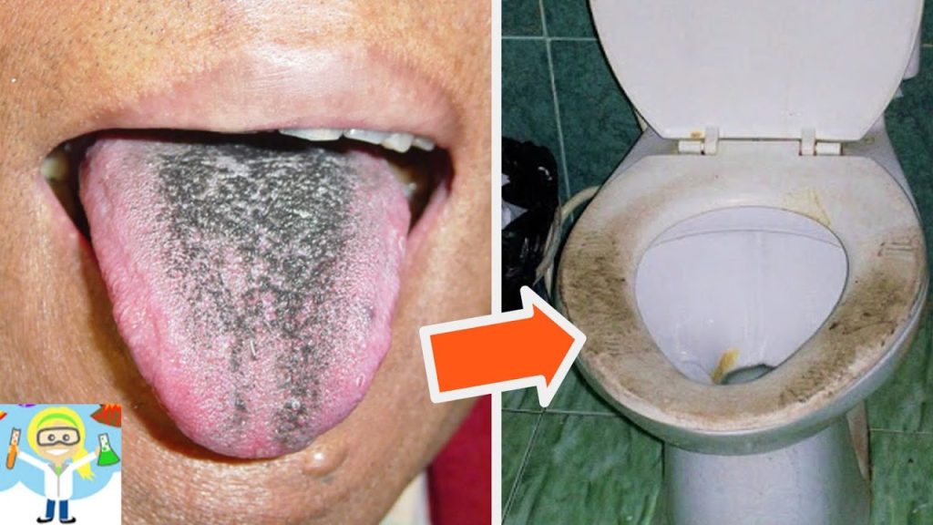 Βίντεο: 10 πράγματα που χρησιμοποιείτε καθημερινά και είναι πιο βρώμικα και απ’ την τουαλέτα σας!