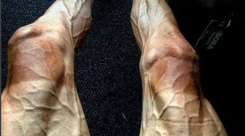 Τον γύρο του Διαδικτύου κάνουν…τα πόδια ενός ποδηλάτη που συμμετείχε στο  Tour de France (φωτό)