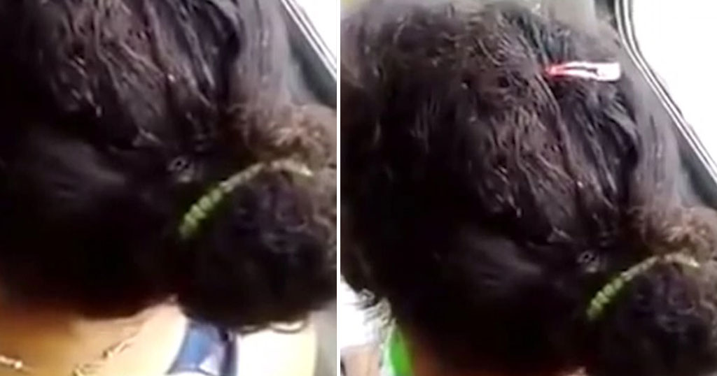 Κεφάλι γυναίκας γεμάτο ψείρες-Ένα βίντεο που απαθανατίστηκε μέσα σε λεοφωρείο