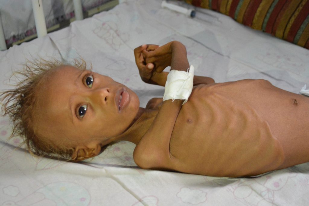 ΟΗΕ: «Θερίζουν» πείνα και λιμοί εξαιτίας των πολέμων σε Αφρική και Υεμένη (φωτό)