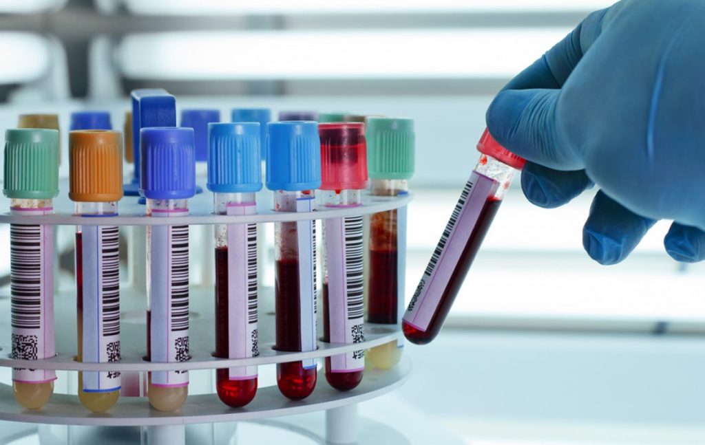 Νέο τεστ αίματος βοηθά στη διάγνωση του καρκίνου