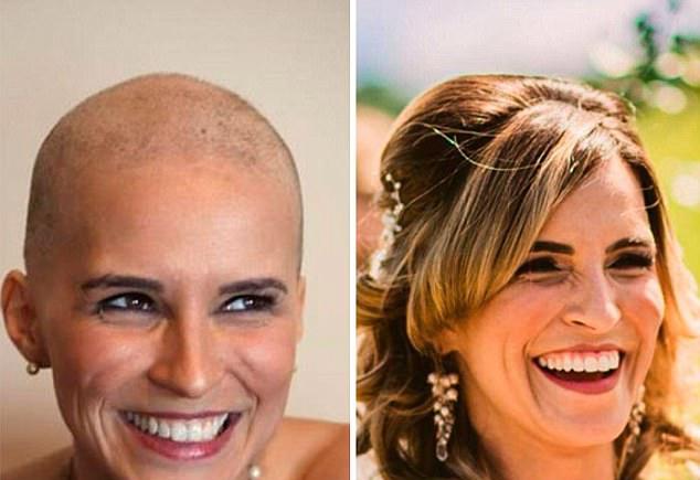 Φωτογραφίες πραγματικών ηρώων – Νίκησαν τον καρκίνο και μας δείχνουν το πριν και το μετά