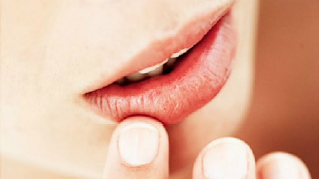 Άφτρες στο στόμα: Φυσικοί τρόποι για να τις αντιμετωπίσετε στο σπίτι