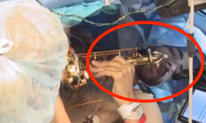 Απίστευτο: Έπαιζε σαξόφωνο την ώρα που τον χειρουργούσαν για την αφαίρεση όγκου απ΄ τον εγκέφαλο! (βίντεο)