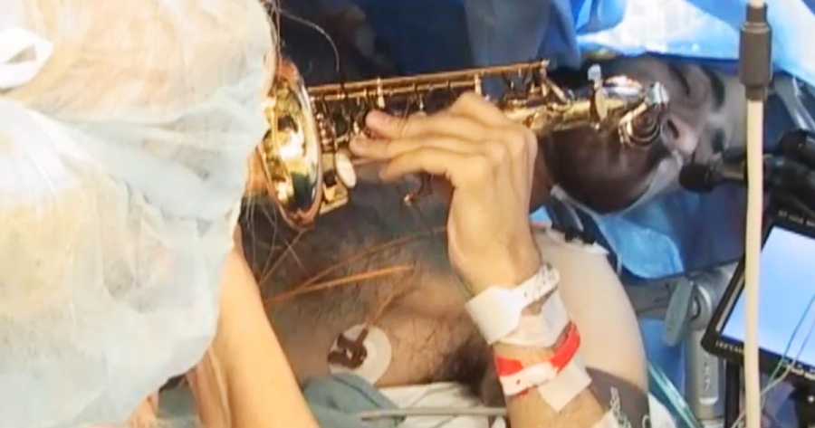 Σαξοφωνίστας δίνει «παράσταση» την ώρα που του αφαιρούν όγκο από τον εγκέφαλο (βίντεο)