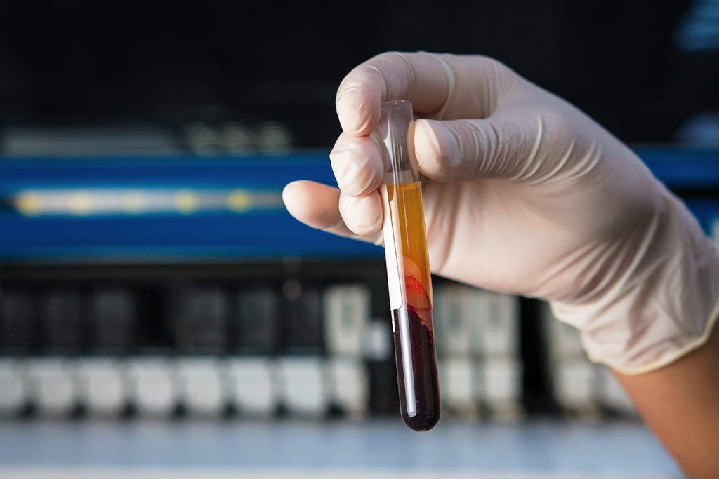 Ποιες ασθένειες είναι πιο συνηθισμένες για κάθε ομάδα αίματος;