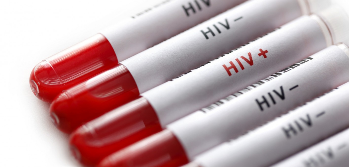 Αυξημένα τα κρούσματα του HIV σε άτομα άνω των 50 σε Ελλάδα και Ευρώπη