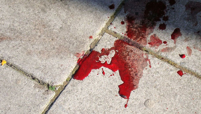 Αιματηρό επεισόδιο στη Χίο: Παράνομος μετανάστης μαχαίρωσε ομοεθνή του στον θώρακα!