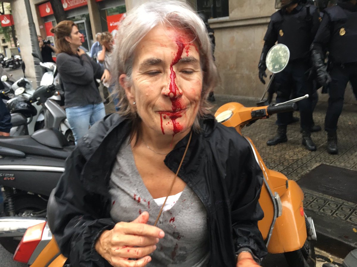«Κοχλάζει» η Ισπανία: Συγκρούσεις Καταλανών αυτονομιστών με τις δυνάμεις ασφαλείας της Μαδρίτης- Στους 761 οι τραυματίες