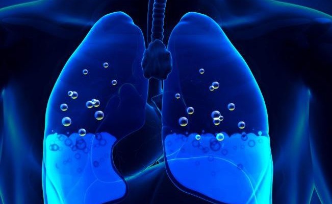 Πνευμονικό οίδημα: Εάν έχετε αυτά τα συμπτώματα υπάρχει κίνδυνος για συσσώρευση υγρού στον πνεύμονα