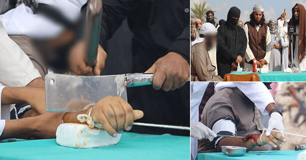 Ισλαμστές δίνουν στη δημοσιότητα σκληρό βίντεο – Κόβουν το χέρι άνδρα ως «ένδειξη» δικαιοσύνης (φωτό, βίντεο)
