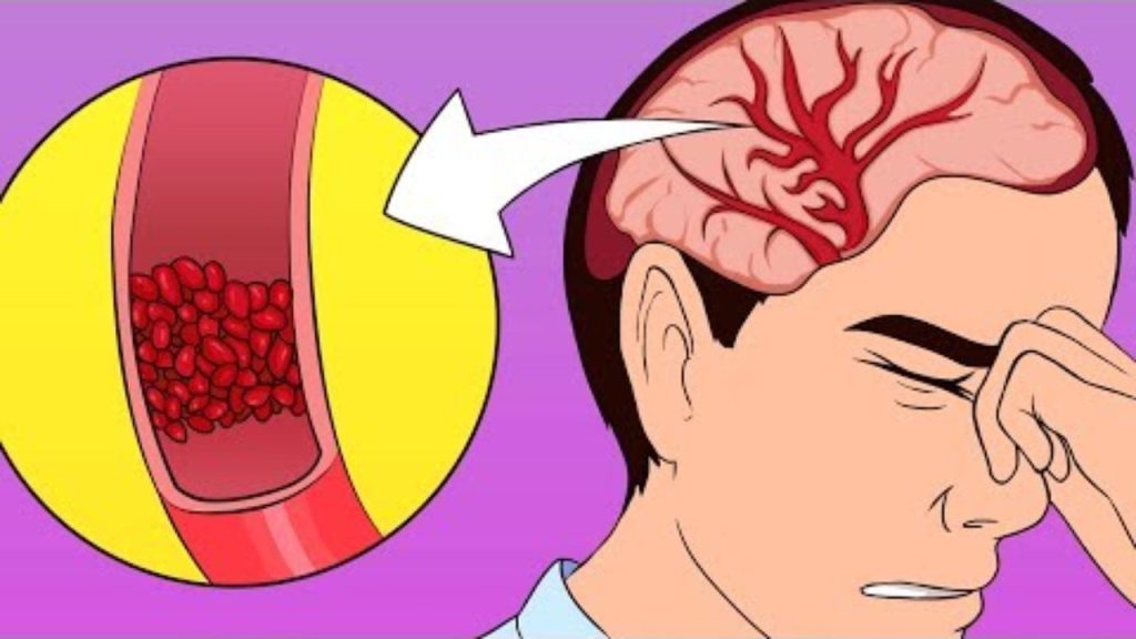 Βίντεο: Πως να θεραπευτείτε από τον πονοκέφαλο χωρίς παυσίπονα!
