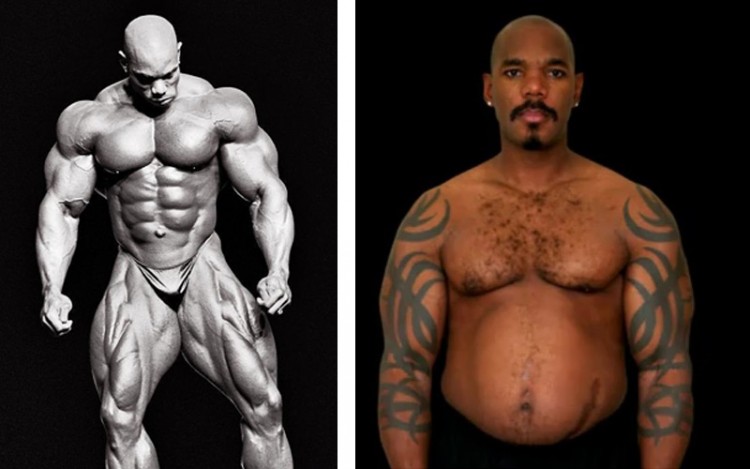 Όταν οι bodybuilders… «ξεφουσκώνουν»: Δείτε τι κάνουν τα αναβολικά και τα «αυξητικά» στο ανθρώπινο σώμα! (φωτό)