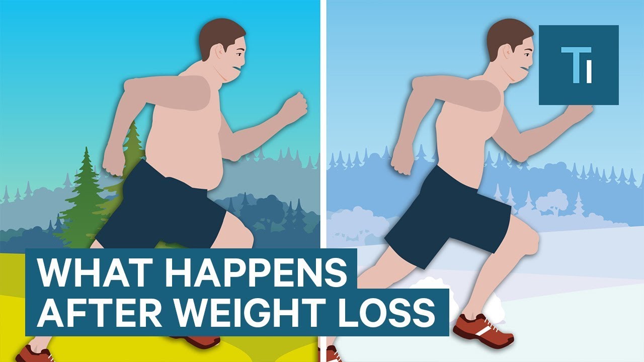 Βίντεο: Πώς η απώλεια βάρους επηρεάζει το σώμα και το μυαλό μας;