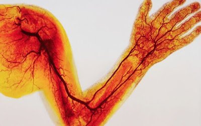 7 απλοί και φυσικοί τρόποι που καθαρίζουν τις αρτηρίες