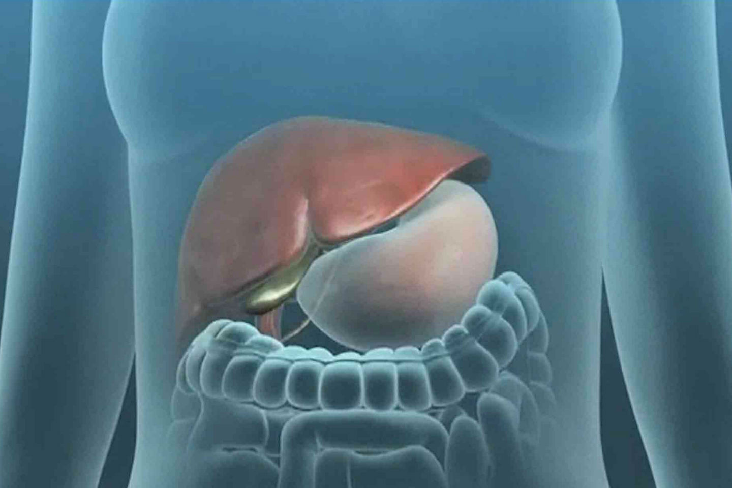 Αίτια και τρόποι αντιμετώπισης για τις πέτρες στην χολή