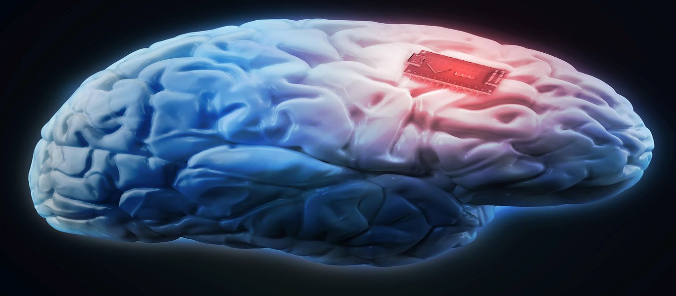 Επανάσταση στην υγεία – Δοκιμάστηκε ο πρώτος «βηματοδότης» εγκεφάλου για Αλτσχάιμερ