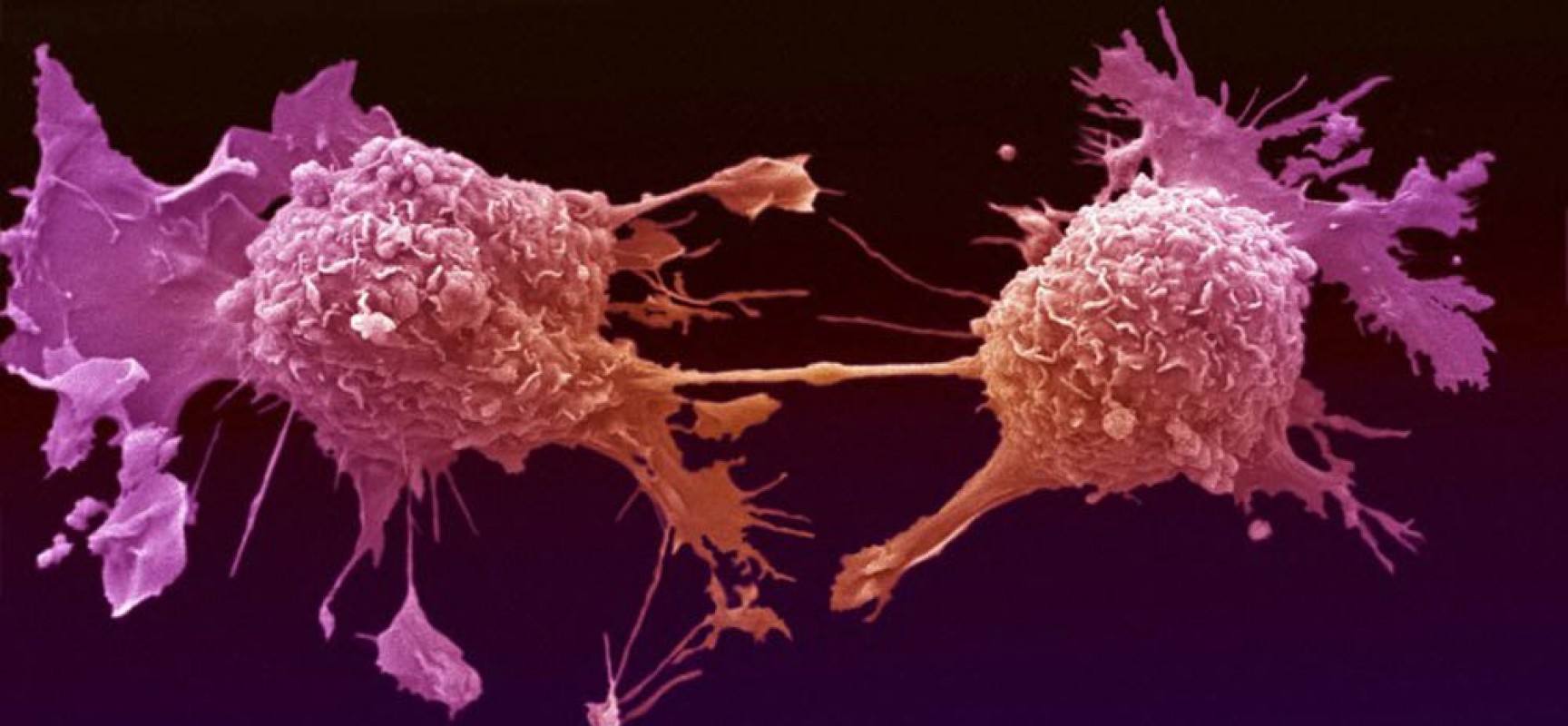 Έλληνες ερευνητές βρήκαν πρωτεΐνη η οποία μπορεί να εξοντώσει τα καρκινικά κύτταρα (φωτό)