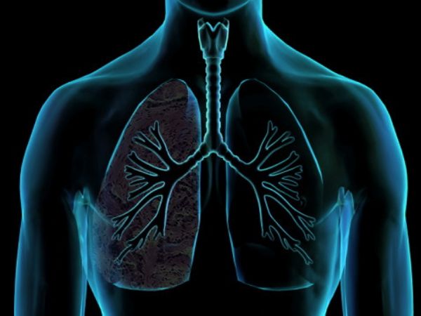 Πνευμονικό οίδημα: Αν νιώθετε αυτά έχετε συσσώρευση υγρού στον πνεύμονα