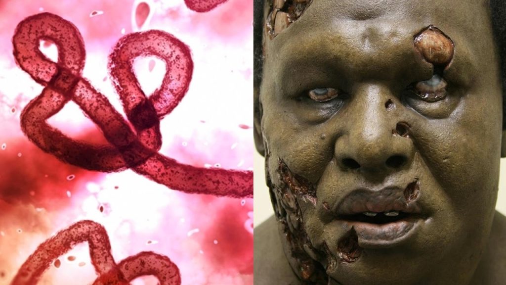 Βίντεο: Οι ασθένειες που θα μπορούσαν να… ξεκληρίσουν τον άνθρωπο