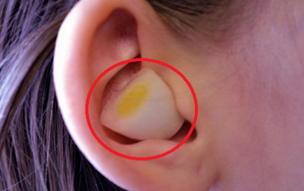 Εσείς ξέρατε τί θα συμβεί αν βάλετε σκόρδο στο αυτί σας;