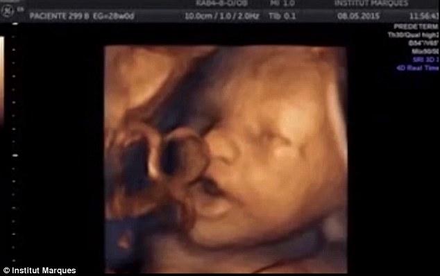 Κι όμως…Τα έμβρυα «τραγουδούν» από την 16η εβδομάδα κύησης (βίντεο)
