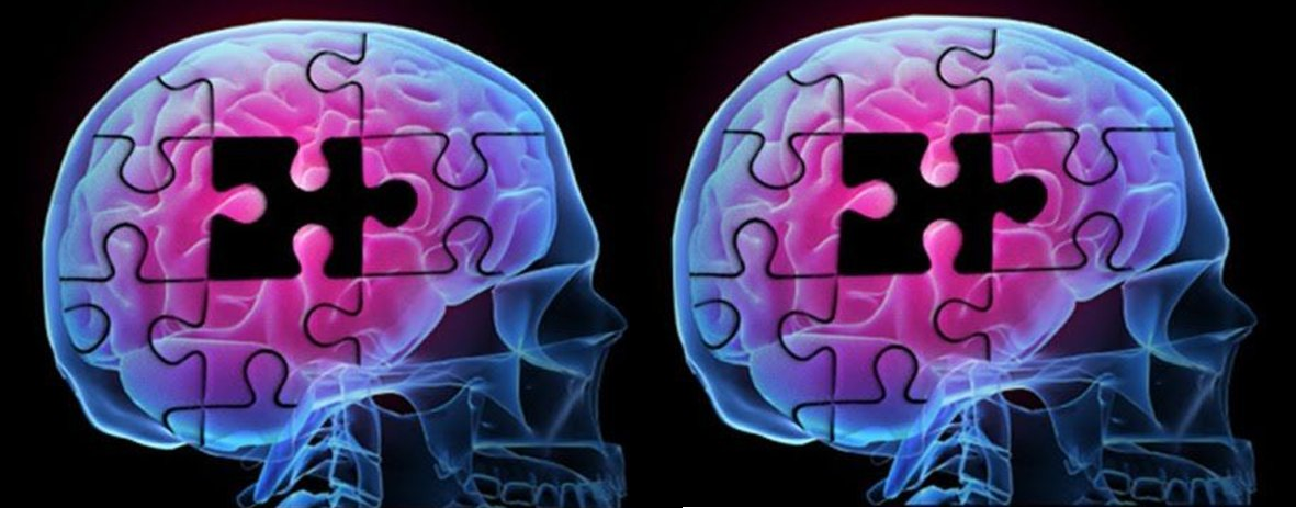Εξετάσεις για Αλτσχάιμερ: Δείτε με ποιους τρόπους γίνεται η διάγνωση