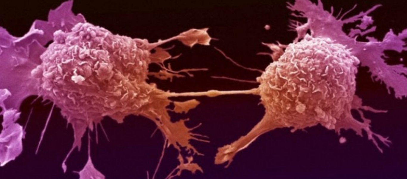 Καρκίνος του προστάτη: Ποιο λαχανικό περιέχει την ουσία που σκοτώνει τα καρκινικά κύτταρα