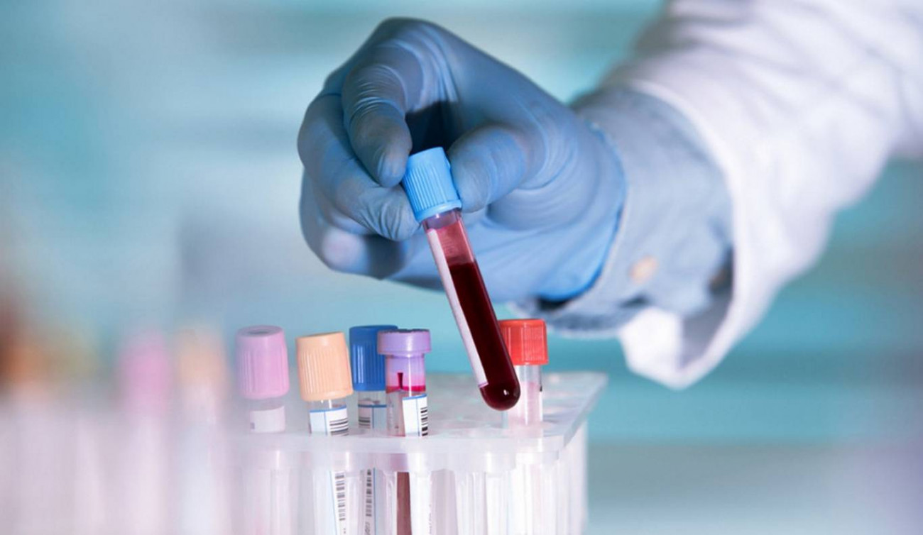 Mεγάλη ανακάλυψη: Τεστ αίματος ανιχνεύει 10 καρκίνους πριν αυτοί αναπτυχθούν