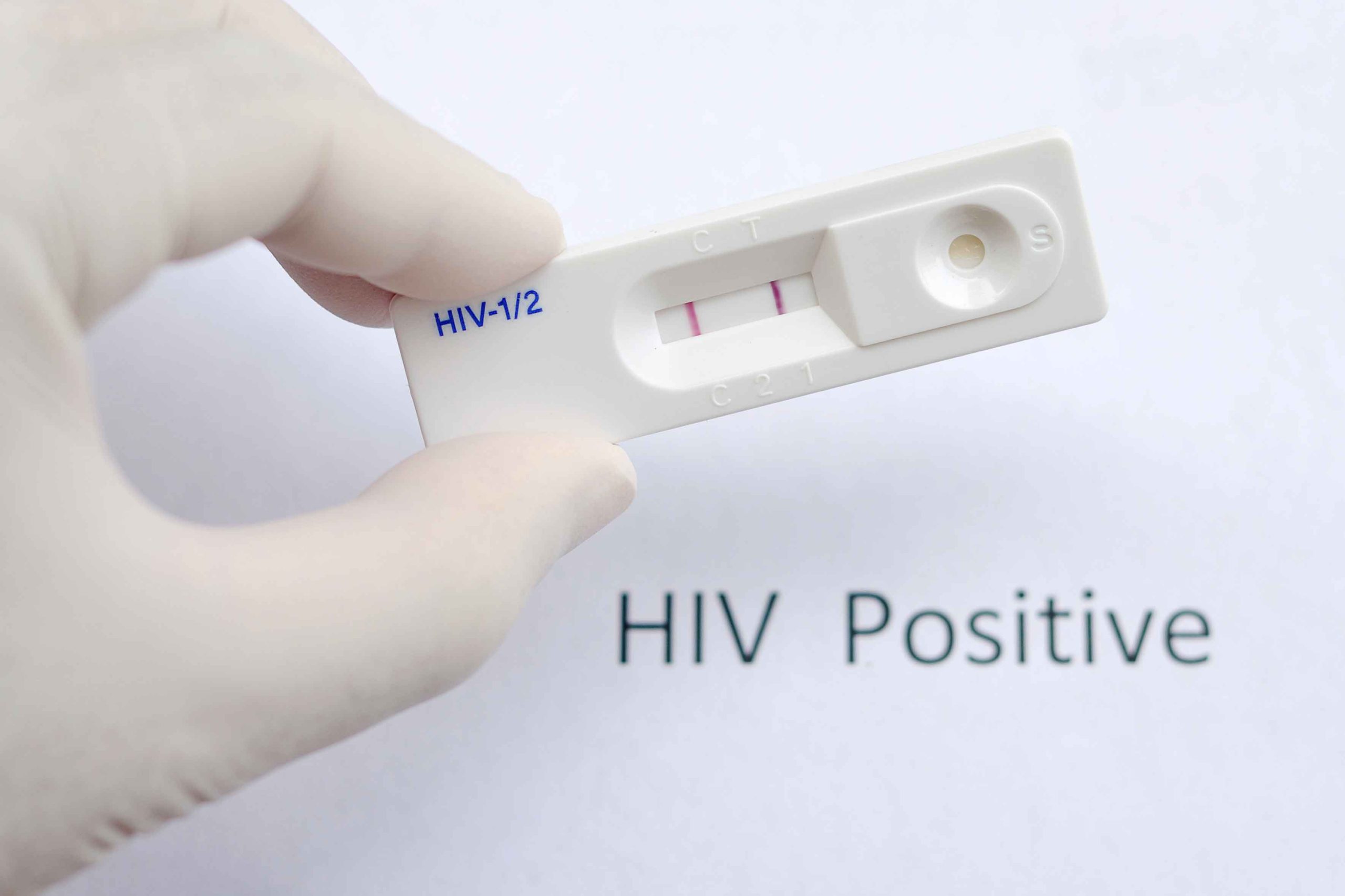 Γερμανία: Ατομικά «τεστ αυτοδιάγνωσης» του ιού HIV στα φαρμακεία για περιορισμό στη μετάδοσή του!