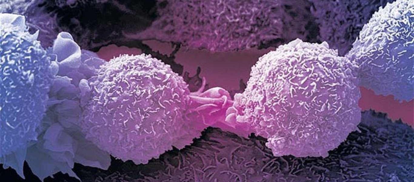 Εξέλιξη που αλλάζει όλα τα δεδομένα: Οι επιστήμονες βρήκαν την «αχίλλειο πτέρνα» των καρκίνων