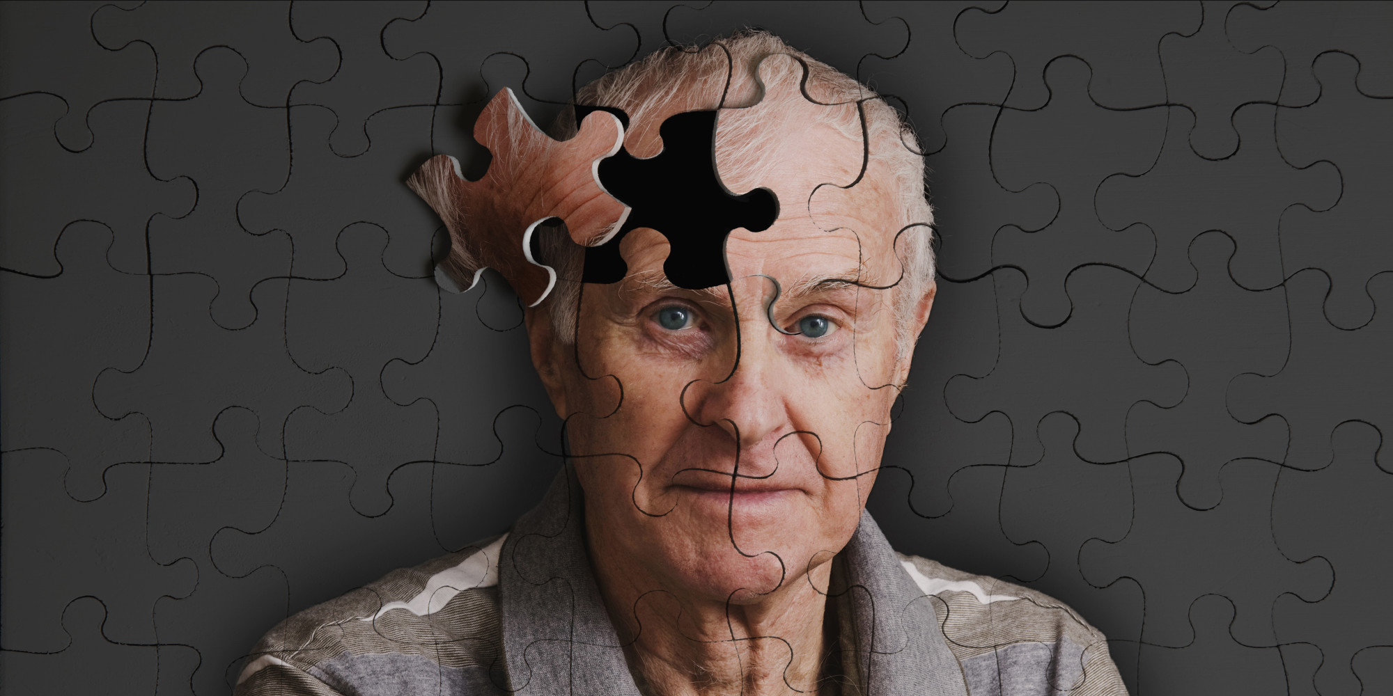 Μεγάλη ανακάλυψη: Βρέθηκε η στιγμή «εκκίνησης» του Αλτσχάιμερ – Ελπίδες για εκατομμύρια ηλικιωμένων
