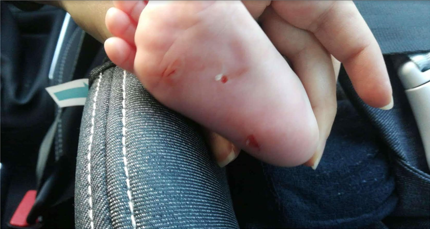 Αδιανόητο: Γυναίκα «χαρακώνει» μωρά στα νότια προάστια της Αθήνας!