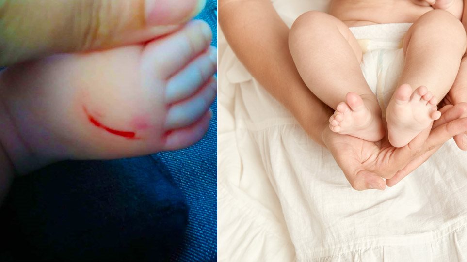 Συνεχίζει τα κτυπήματα η επικίνδυνη γυναίκα που «χαρακώνει» βρέφη: Άλλα 2 περιστατικά