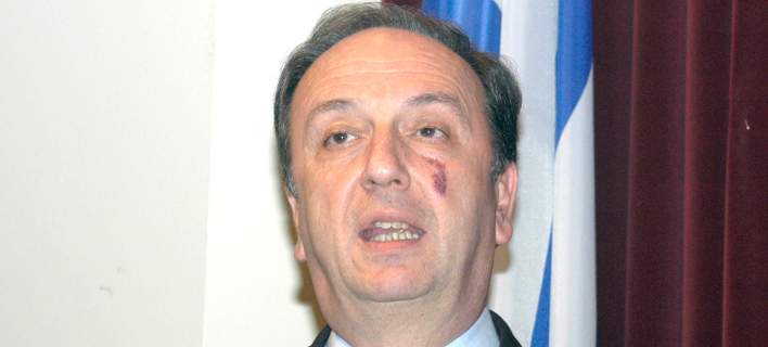 Πέθανε ο πρώην υπουργός της ΝΔ Γιώργος Καλός