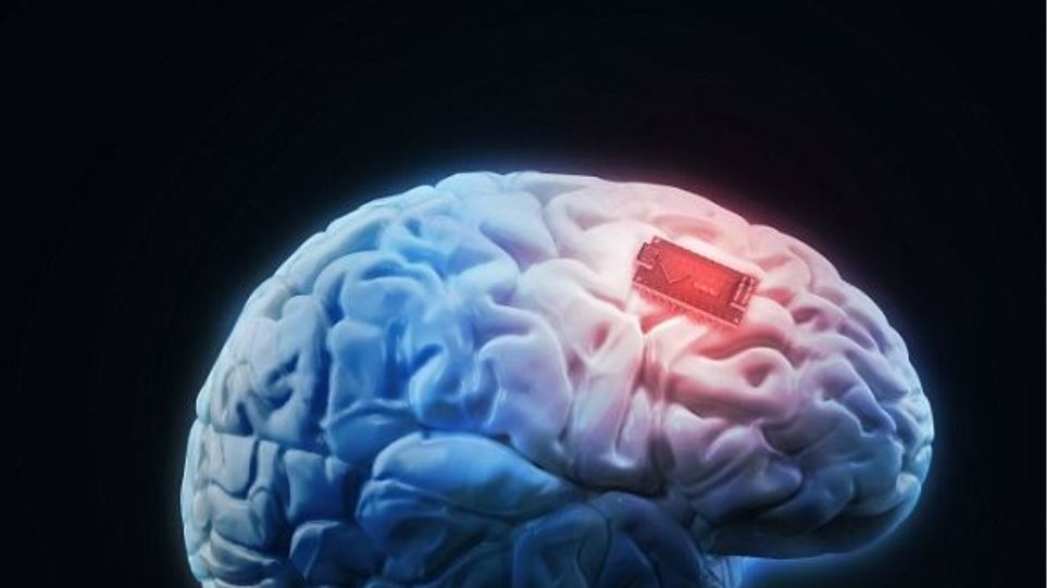 Εμφύτευμα στον εγκέφαλο μπορεί να θεραπεύσει επιληπτικές κρίσεις;