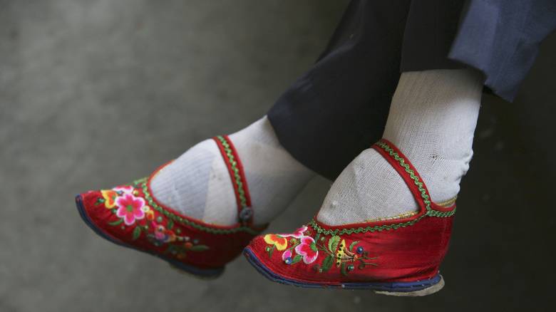 «Τα πόδια του λωτού»:Το βασανιστικό κινεζικό έθιμο με τα παραμορφωμένα πόδια (φώτο)
