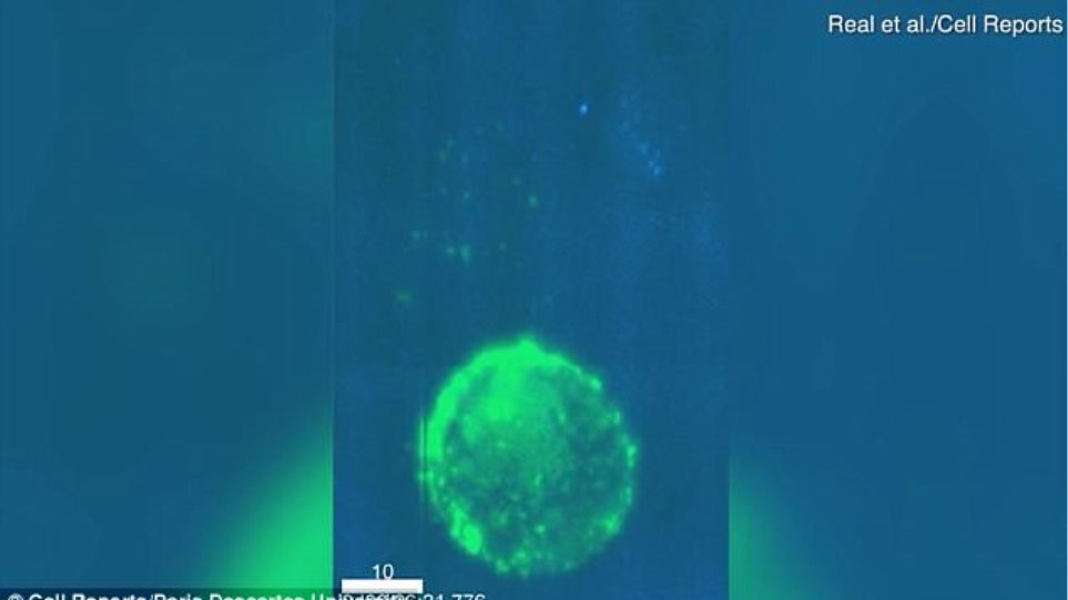 Πως ένα κύτταρο μολυσμένο με HIV προσβάλλει υγιή οργανισμό κατά τη διάρκεια της επαφής (βίντεο)