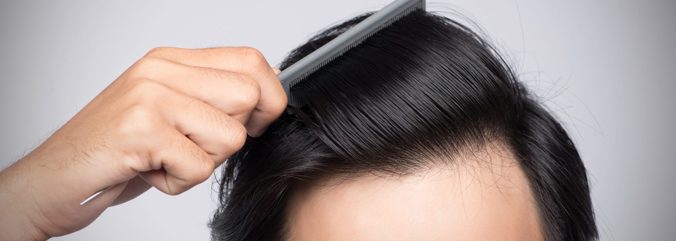 Αραίωση στα μαλλιά- Πότε είναι σημάδι για κάτι σοβαρό